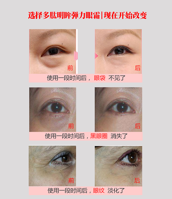 芳香人生化妆品加盟多肽眼霜使用前后700.jpg